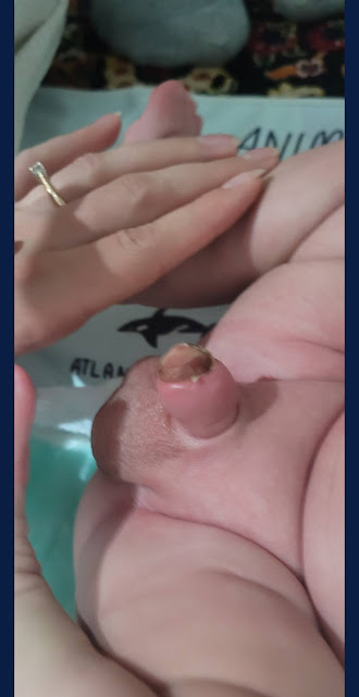 تورم طبیعی در روزهای بعد 4